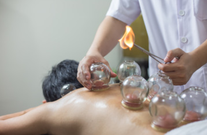 cupping-massage_roma.png